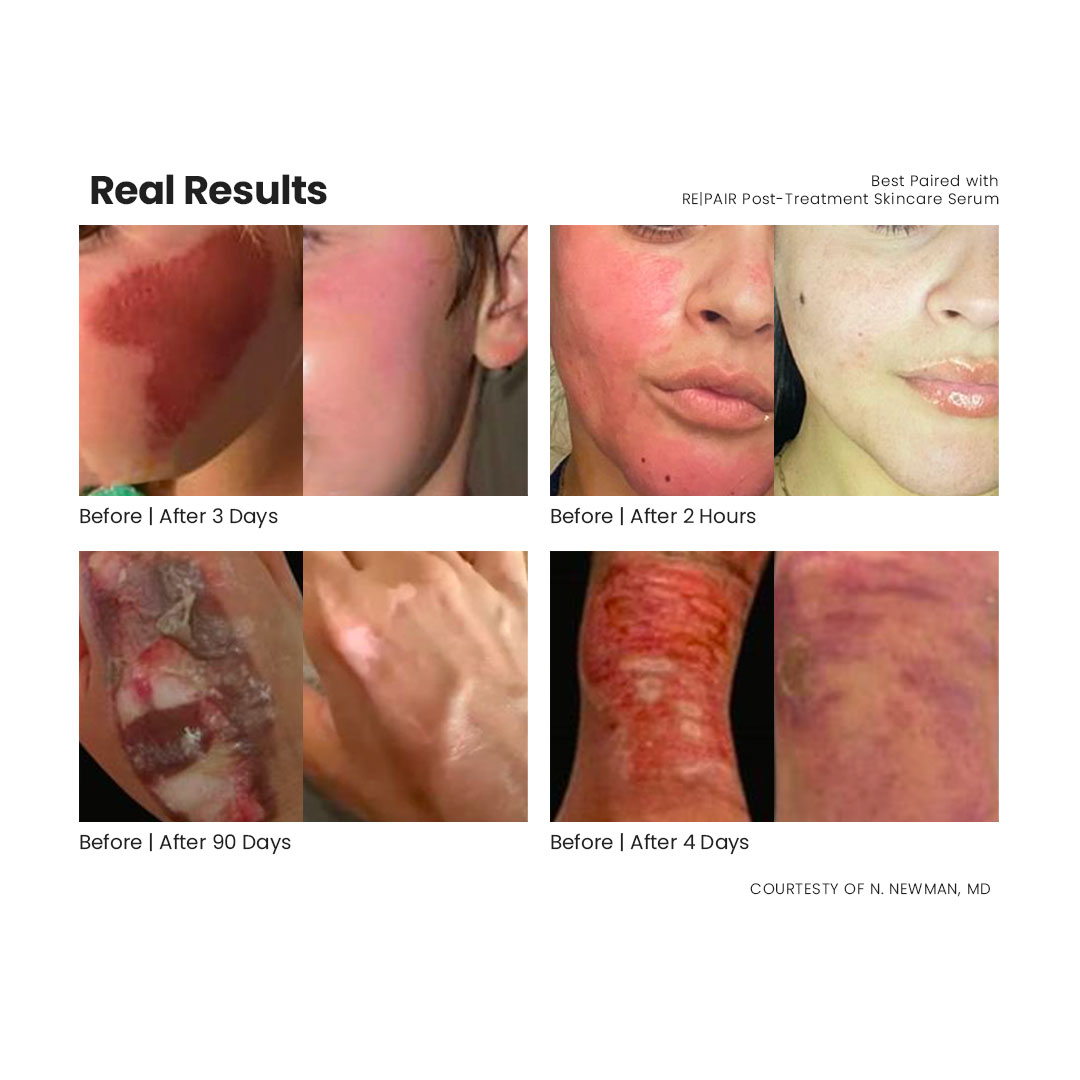 D|TOX Pre-Treatment Skincare Serum (30ml) - Image 3